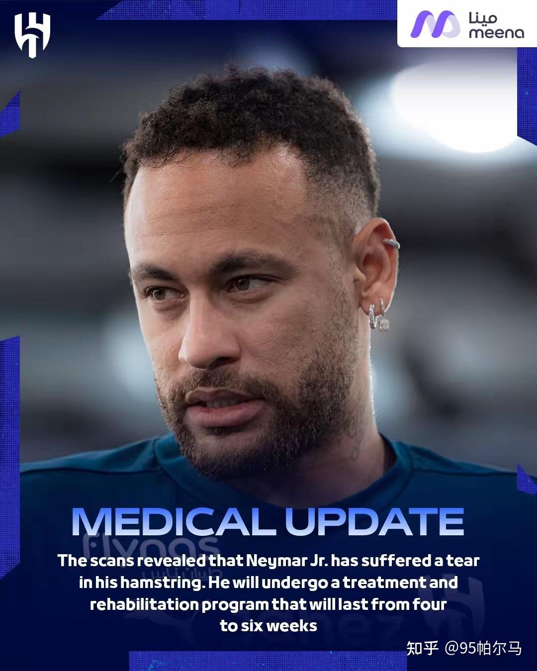 1xBit体育网站-内马尔受伤，巴黎对尤文图斯之战存疑的简单介绍